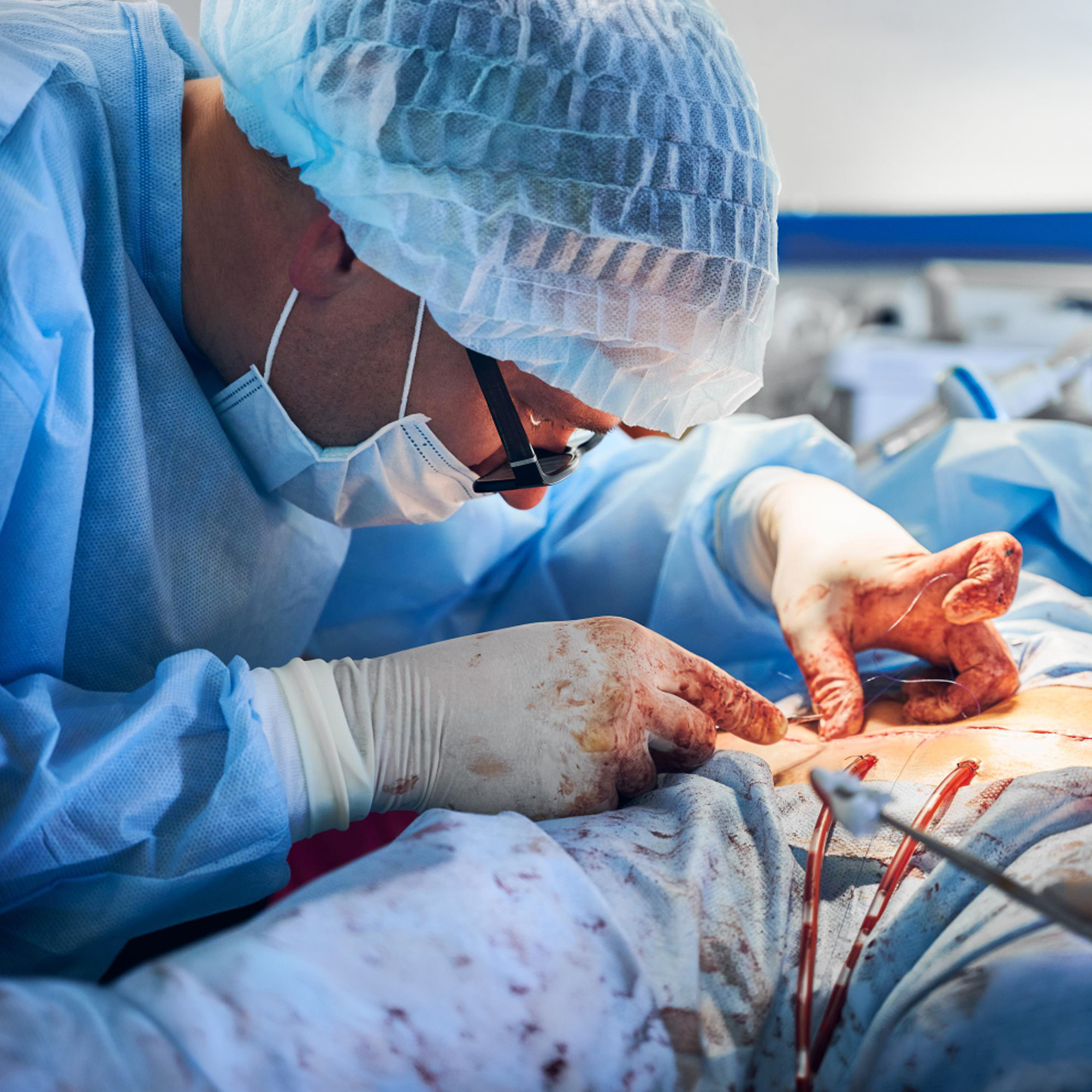 Heart Valve Replacement (AVR/MVR)