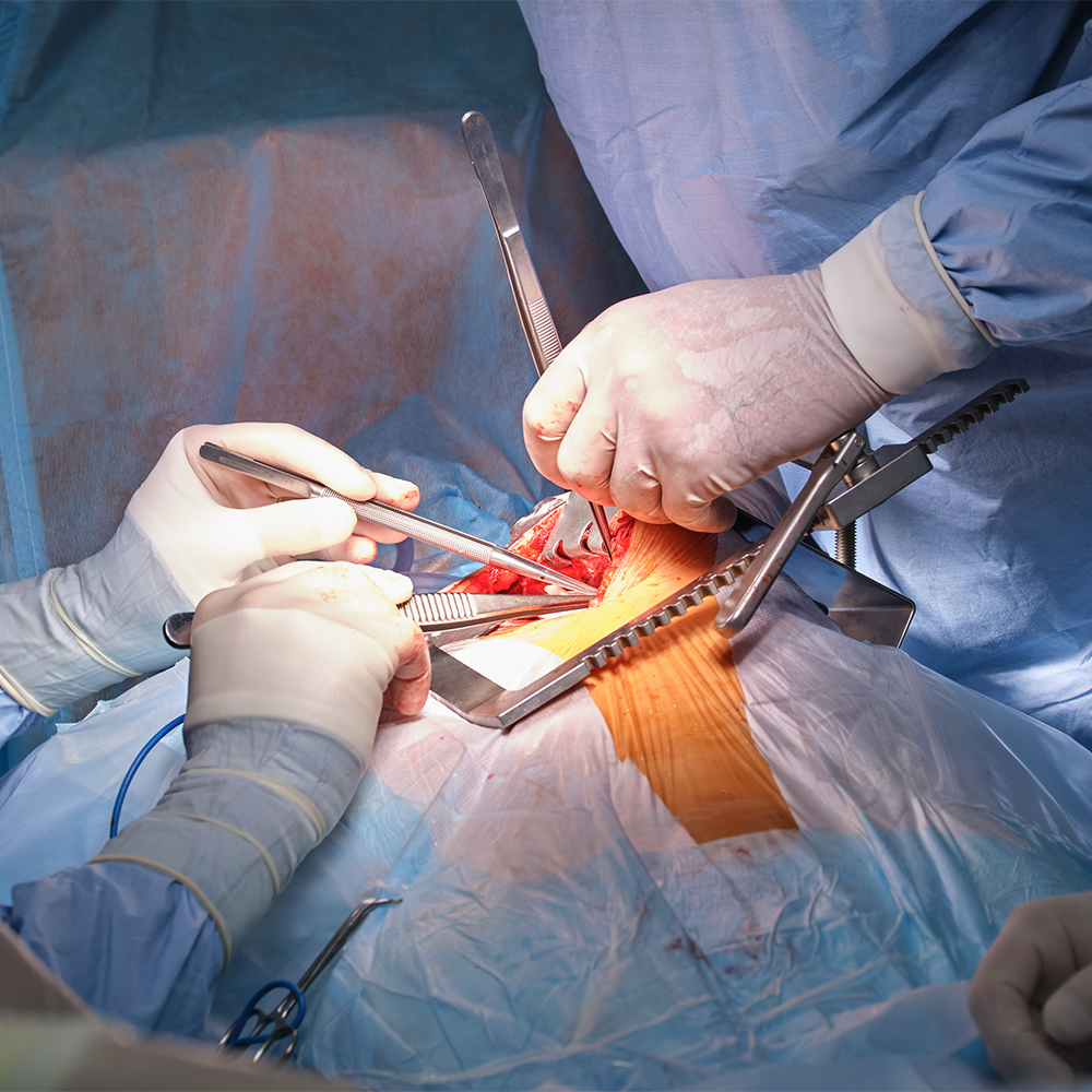 Bentall Surgery