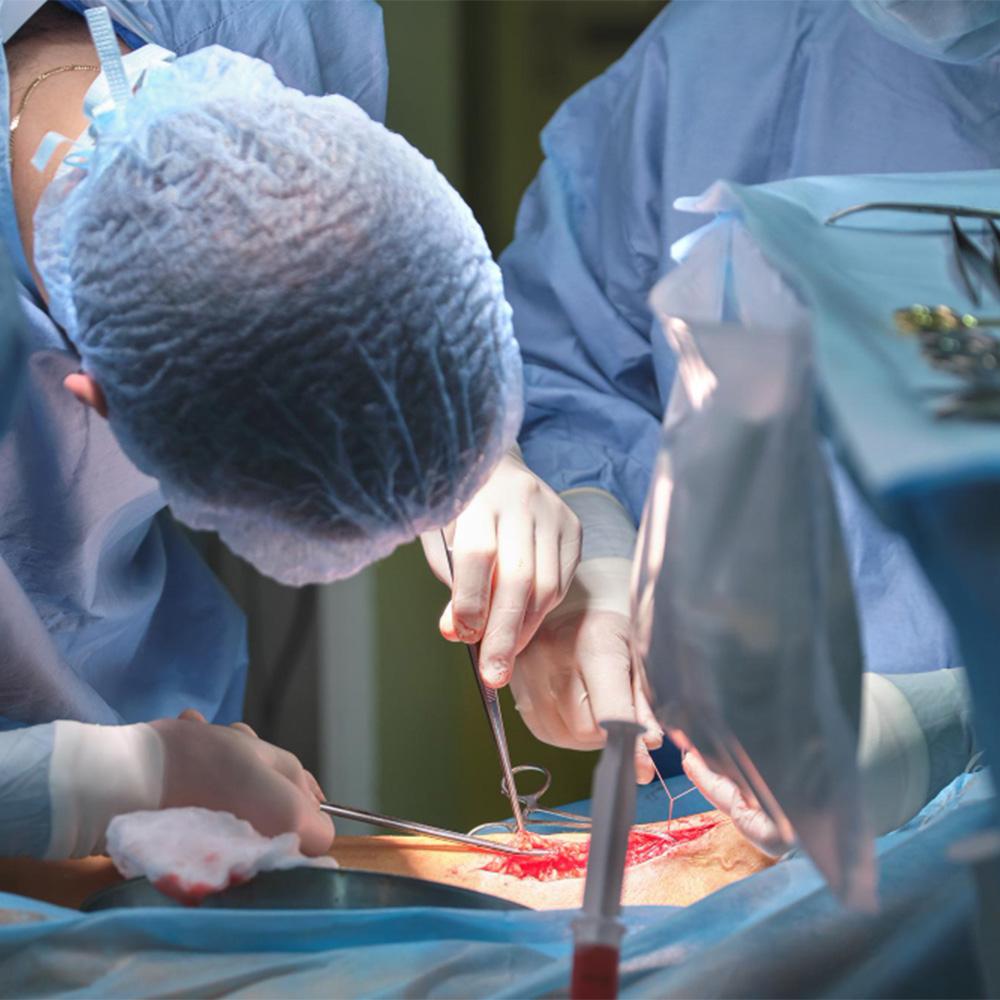 TAVI Procedure