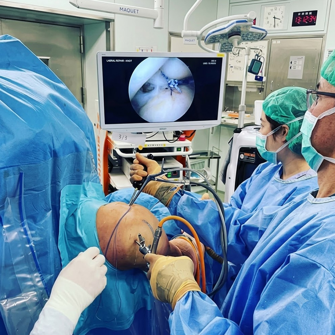 Anterior Cruciate Ligament Surgery