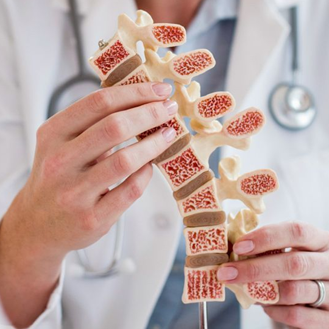 Adult Bone Marrow Transplant