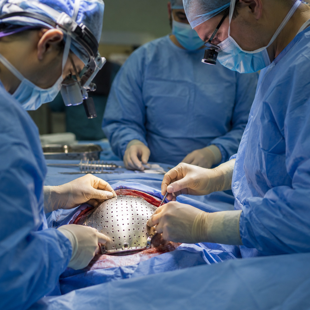 Cranioplasty
