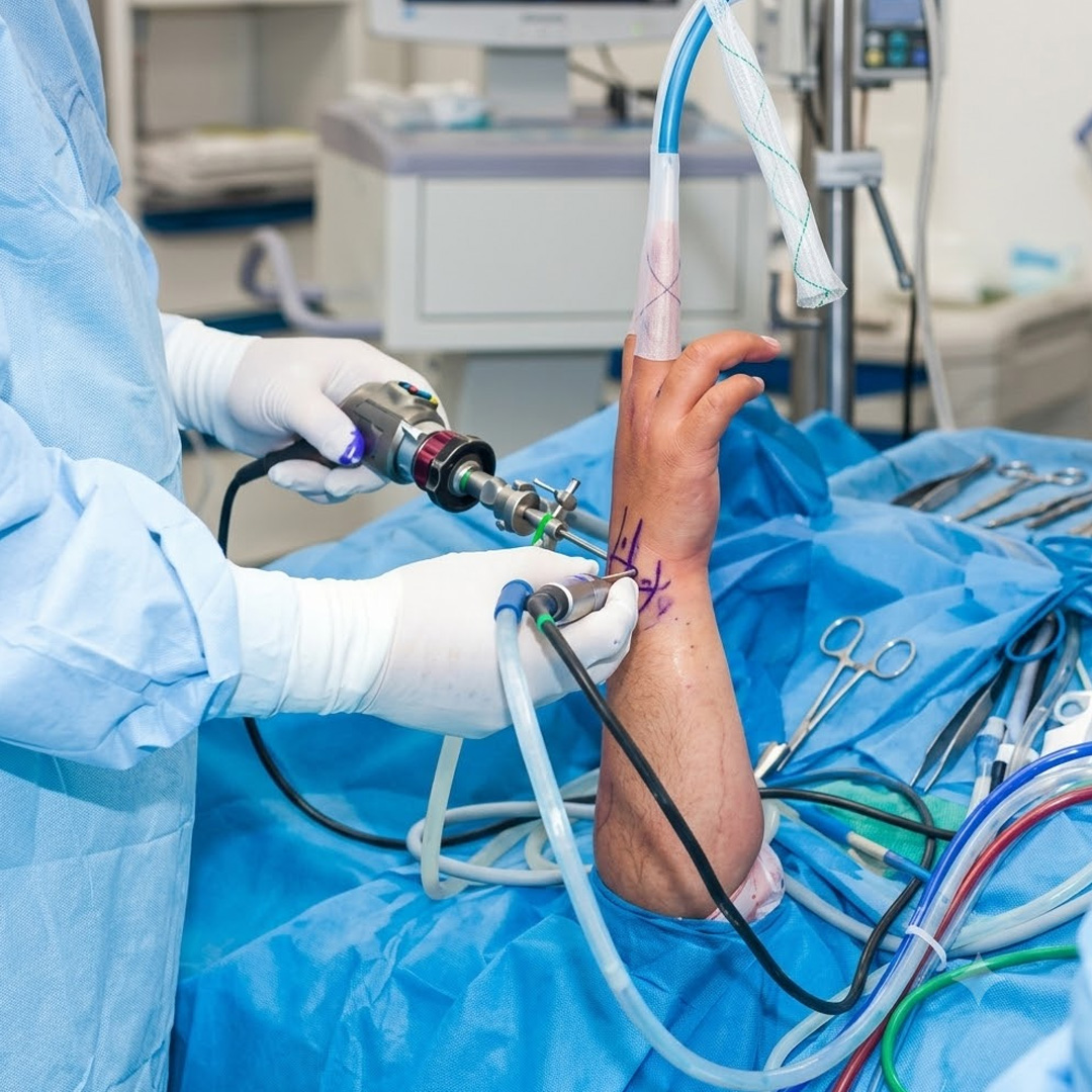 Elbow Arthroscopy