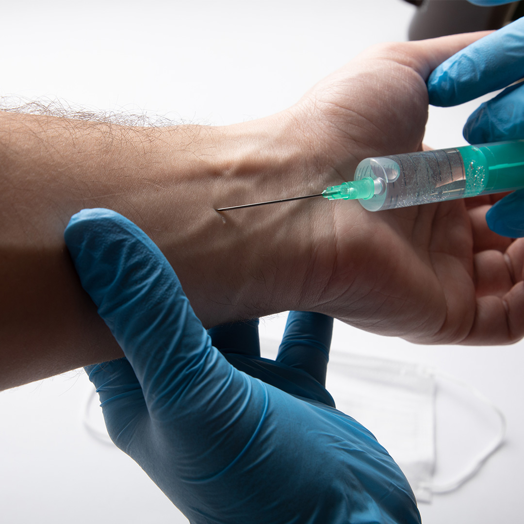 Nerve Transfer
