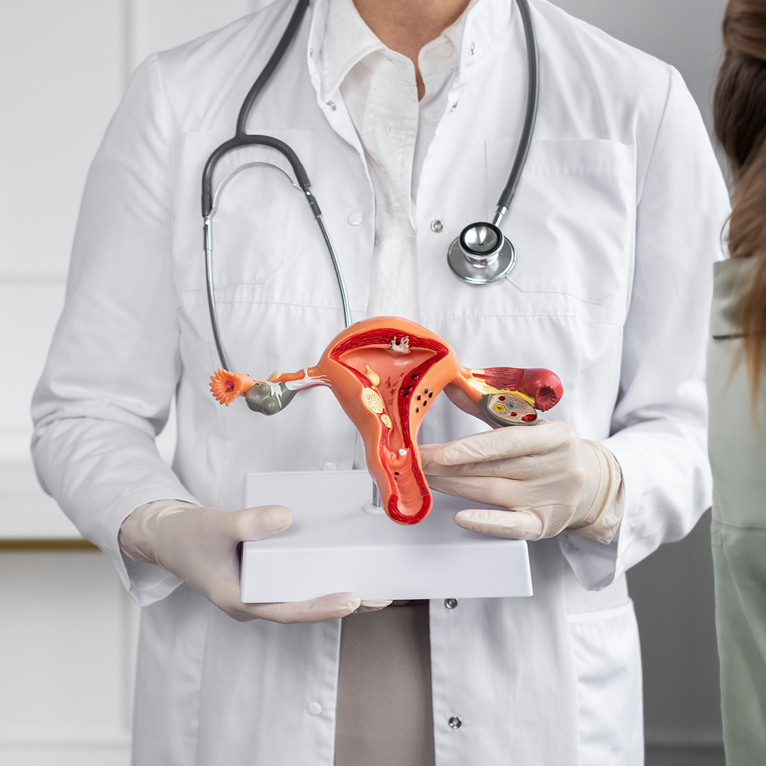 Ovarian Surgery