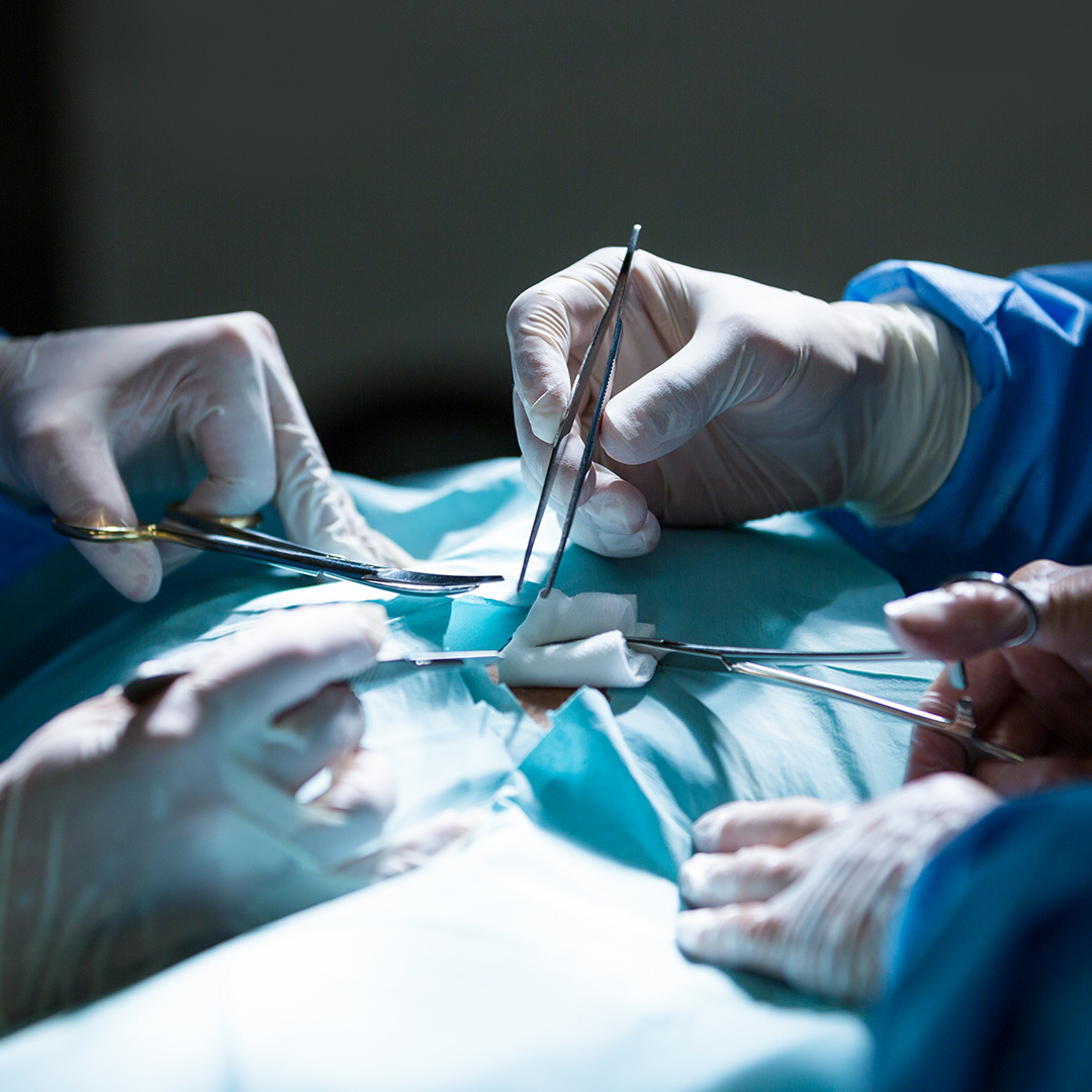 Urinary Bladder Surgery